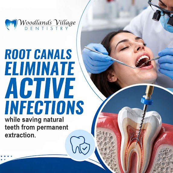 root canals
